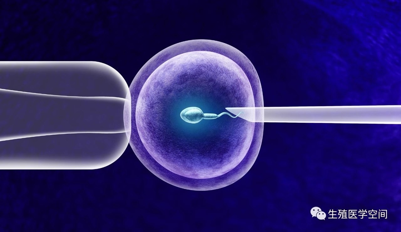 肌腺症辅助生殖技术