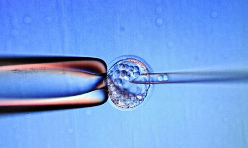 聊城试管婴儿技术进展与临床应用