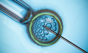 美国赴美生子指南