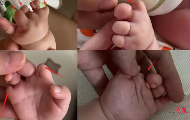 美国试管婴儿费用与流程