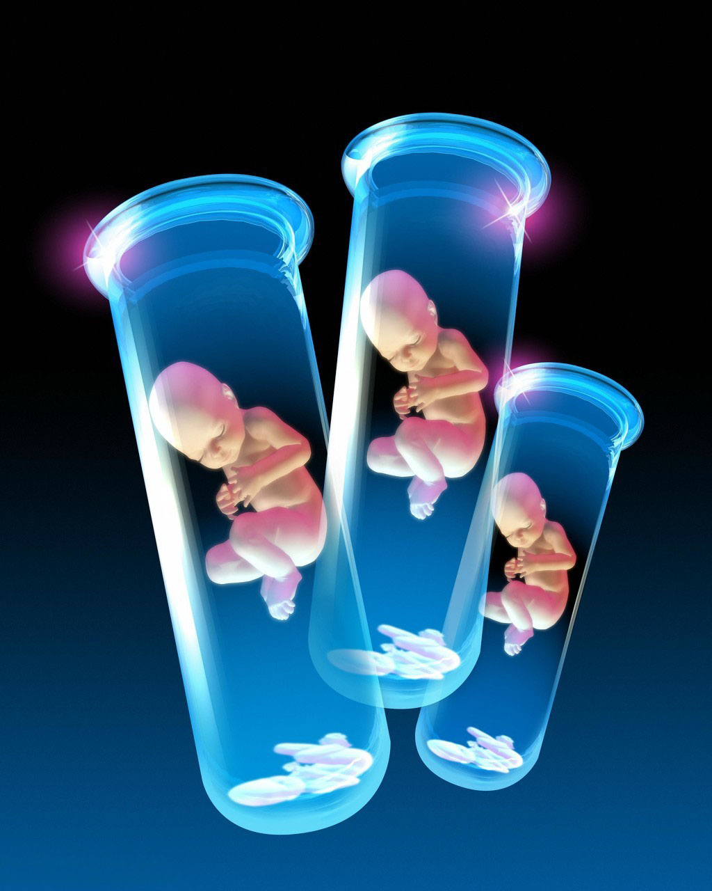 胎停育胚胎染色体异常