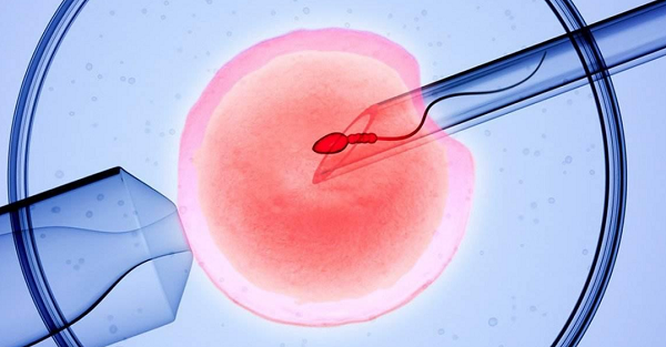 肥胖与女性不孕的相关性研究