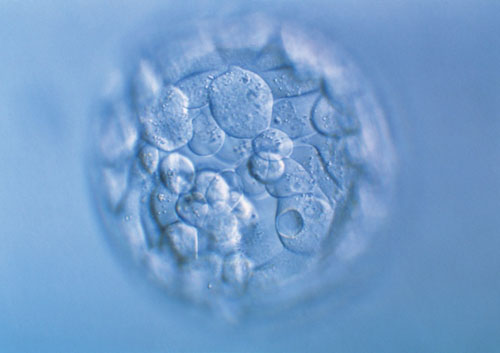 美国试管婴儿技术:现状与展望 美国试管婴儿技术:现状与展望